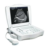 ultrasound scanner for sale